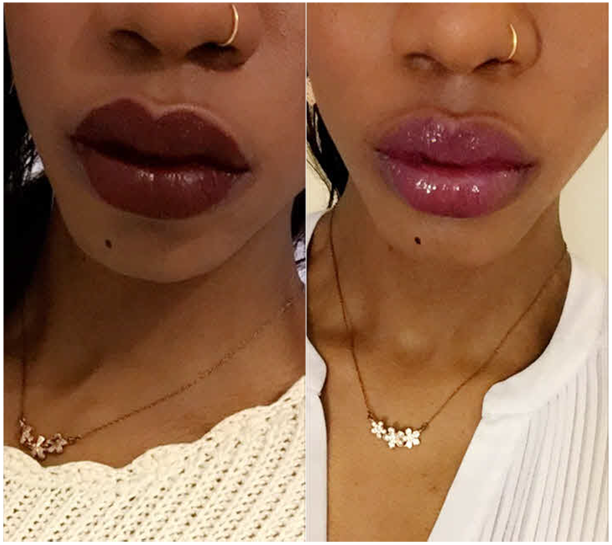 nia-lips